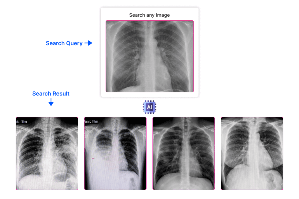 healthcare image analysis medical imaging image similarity